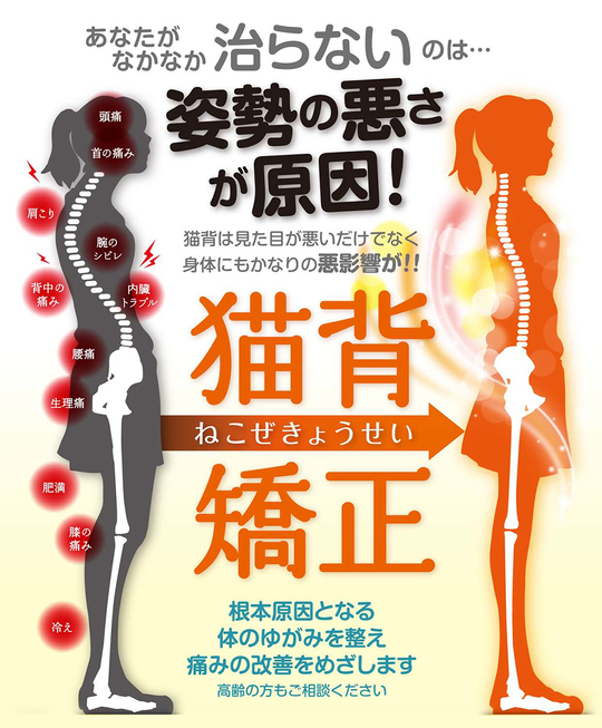 猫背矯正について - 六本木の整体なら姿勢治療院tetote